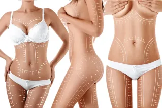A professional therapist applies kinesiology tape to a woman's back during a physiotherapy session.